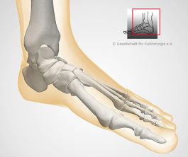 Knochenskelett Fuß