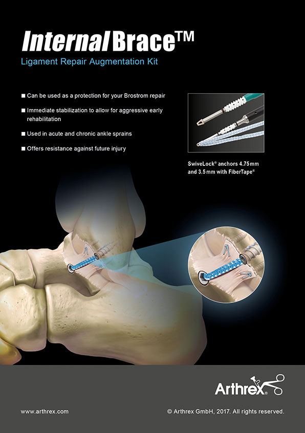 Implantat Knochen
